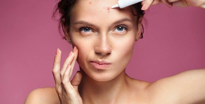 acne overnight treatment