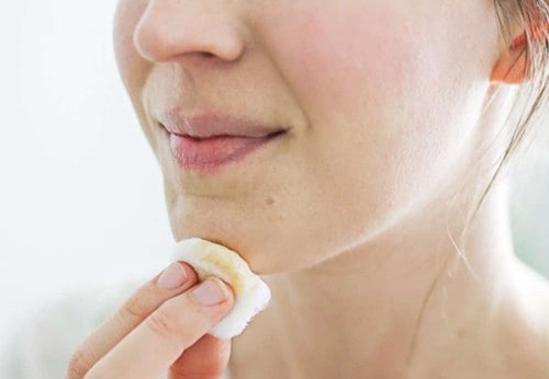 chin acne treatment